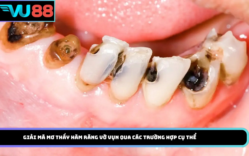 Giải mã mơ thấy hàm răng vỡ vụn qua các trường hợp cụ thể