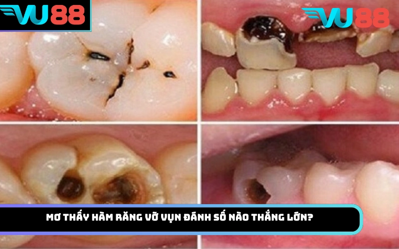 Mơ thấy hàm răng vỡ vụn đánh số nào thắng lớn?