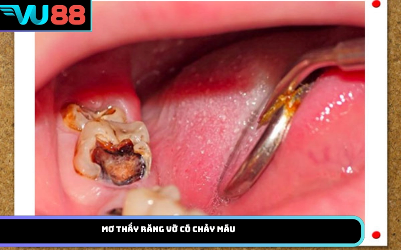 Mơ thấy răng vỡ có chảy máu