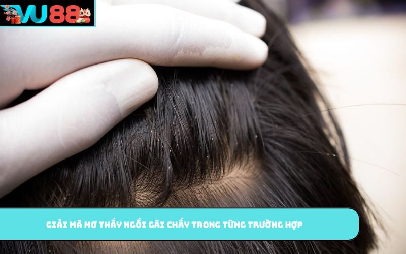Giải mã mơ thấy ngồi gãi chấy trong từng trường hợp