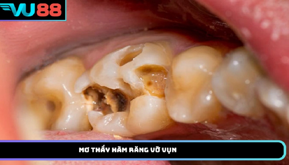 VU88 Mơ Thấy Hàm Răng Vỡ Vụn: Những Thông Điệp Đáng Chú Ý