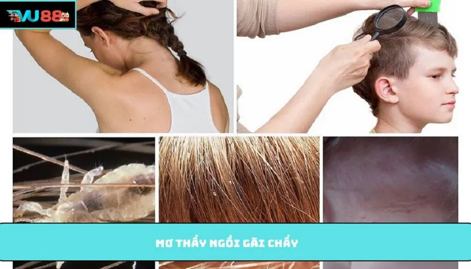 VU88 Giải Mã Giấc Mơ Thấy Ngồi Gãi Chấy Và Những Con Số May Mắn