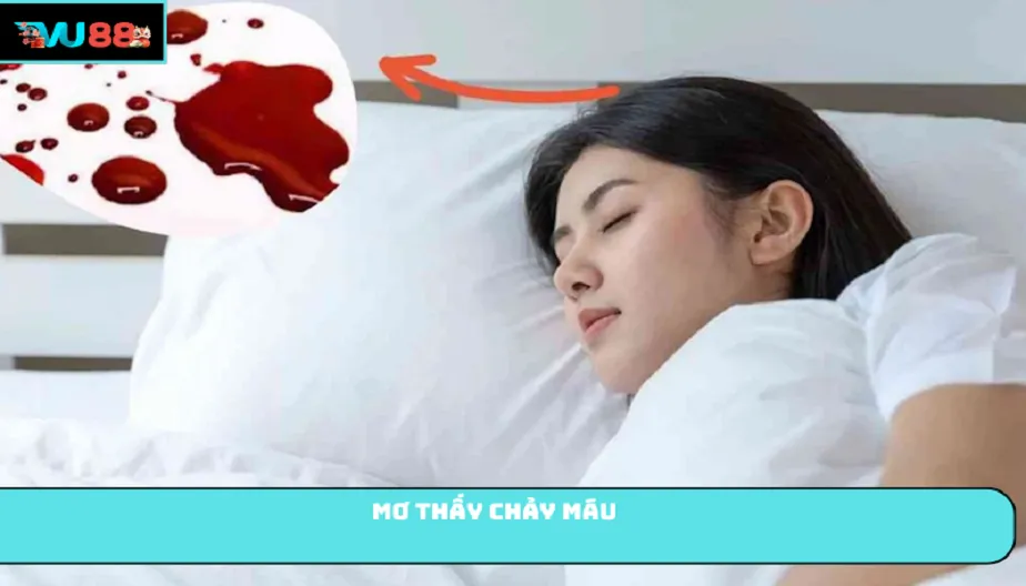 VU88 Mơ Thấy Chảy Máu: Giải Mã Từng Trường Hợp Và Con Số Đẹp